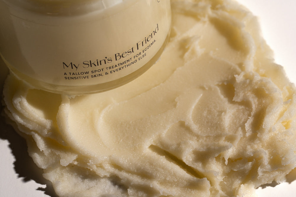 My Skin’s Best Friend - Eczema Relief Cream with Tallow, Bee Propolis, and Emu Oil